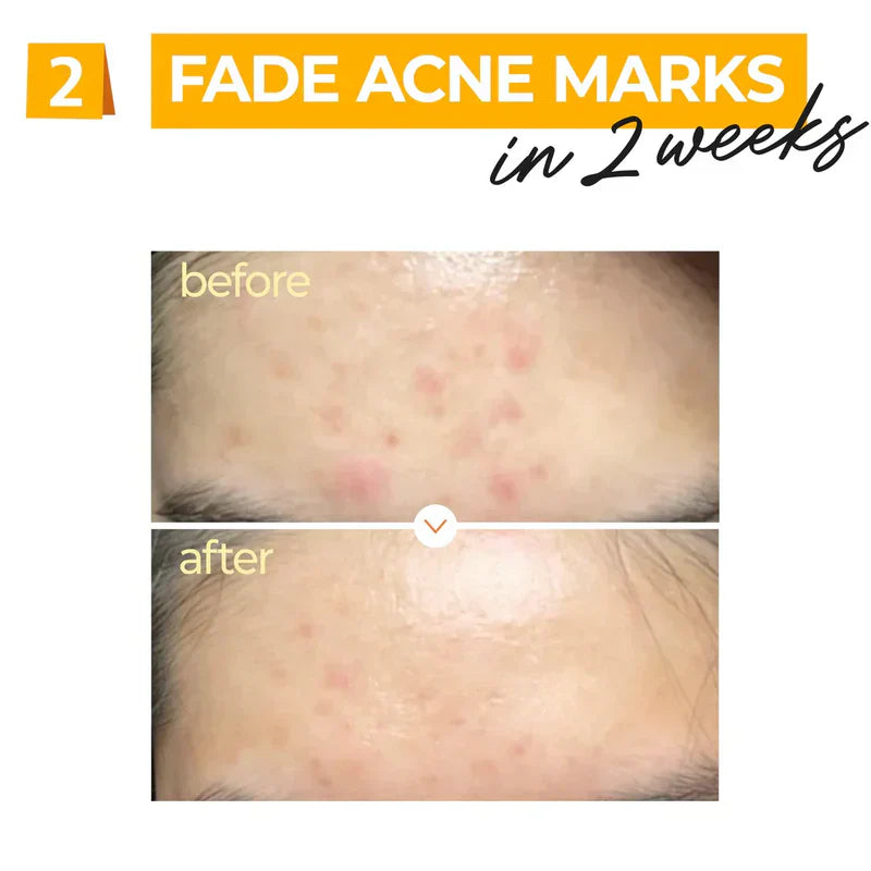 Numbuzin No.5 Vitamin Concentrated Serum 30ml